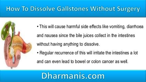 How To Naturally Dissolve Gallstones Without Surgery