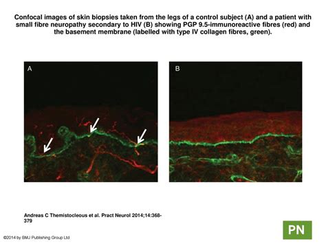 Confocal Images Of Skin Biopsies Taken From The Legs Of A Control