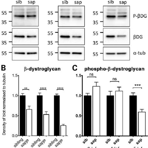 Levels of β dystroglycan and β dystroglycan phosphorylated on tyrosine