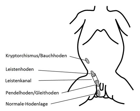 Ukgm Gie En Marburg Hodenhochstand