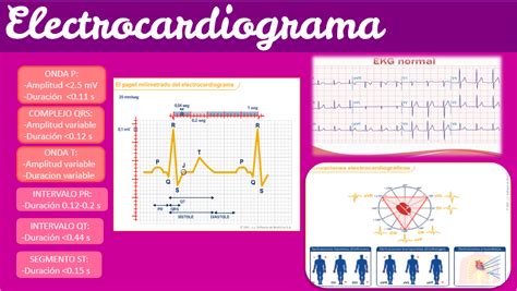 Yolva De Fisiologia Electrocardiograma E Interpretacion De Ekg