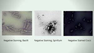 Negative Staining - Principle, Procedure, Result - Biology Notes Online