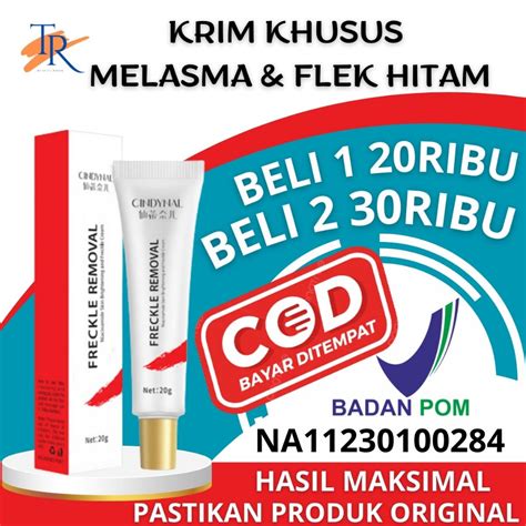 Jual Bpom Cindynal Salep Melasma Dan Flek Hitam Membandel Diwajah