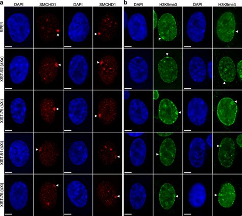 Heterochromatin Characterization In Xist Mutants A Distribution Of