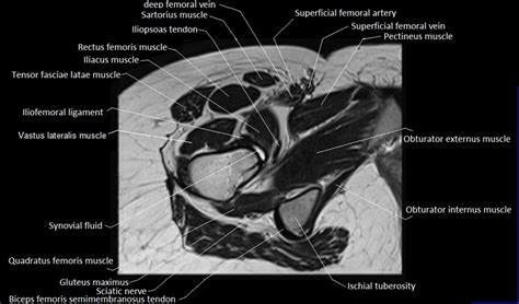 MRI Anatomy Of Hip Joint Free MRI Axial Hip Anatomy, 46% OFF