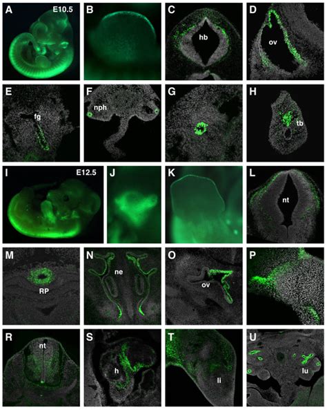 Reporter Transgene Expression During Midgestation A Widefield