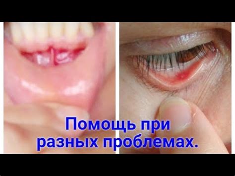 Аюрведический бальзам-спасатель Кайлаш Дживан. Kailas Jeevan. - YouTube