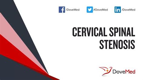 Cervical Spinal Stenosis Dovemed