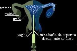 Insemina O Artificial Etapas Da Insemina O Artificial