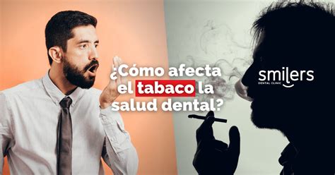 ¿cómo Afecta El Tabaco En La Salud Dental El Cigarro Y La Salud Bucal