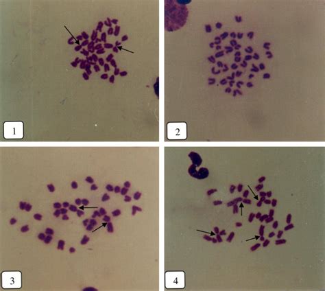 Photomicrograph Of Mouse Bone Marrow Cells At Normal Metaphase Stage