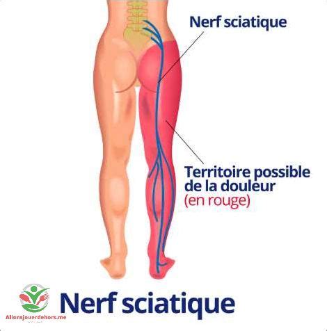 Sciatique jambe droite symptômes causes et traitements Actualisé