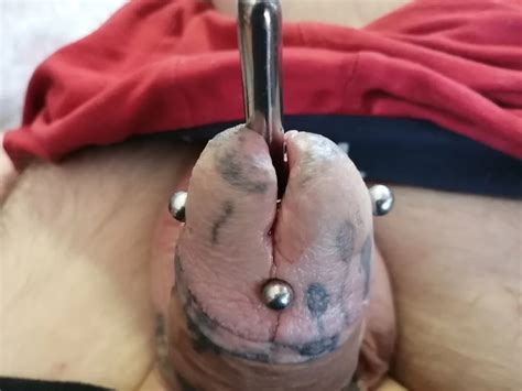 Sounding Urethra 41 Nude Pics XHamster