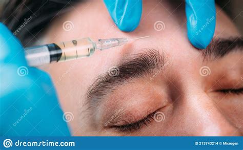 Beauty Treatment For Men Dermal Fillers Face Treatment Stock Photo