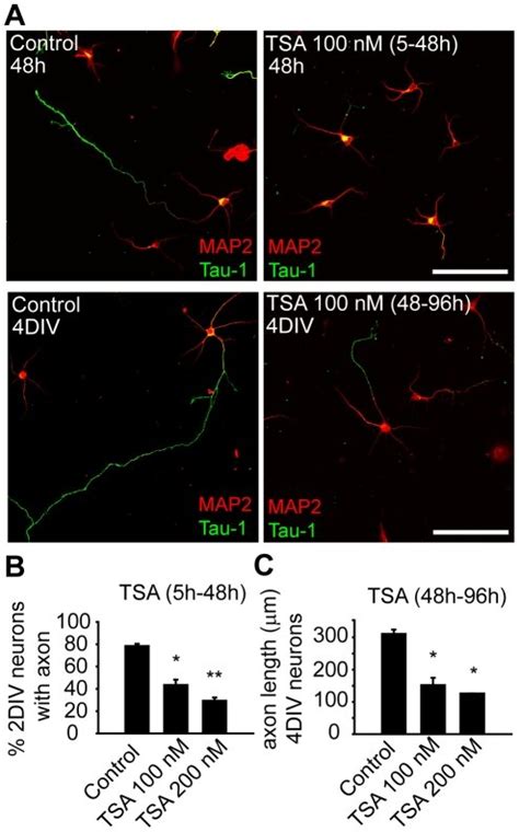 (A) 2 DIV hippocampal neurons cultured for 48 hours in the presence or ... 