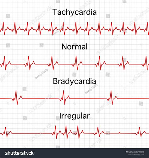 Heart Rate Graphics Vector Illustration Electrocardiogram Stock Vector (Royalty Free) 2212461171 ...