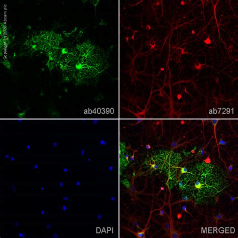 Anti-Myelin Basic Protein antibody (ab40390) | Abcam