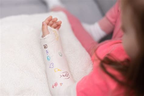 Study Could Prompt Rethink In Treatment Of Wrist Fractures In Children