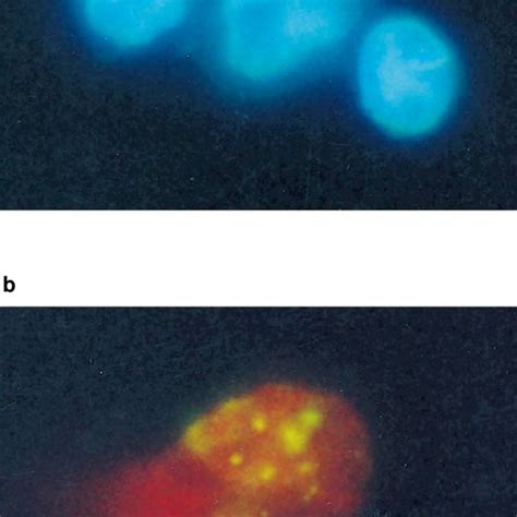 Fluorescence Microscopy Analysis Of Hsv 2 Infected U937 Cells Control