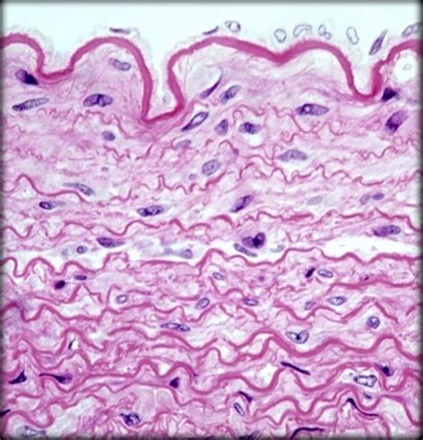 Elastic Connective tissue Diagram | Quizlet