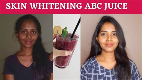 Skin Whitening Abc Applebeetrootcarrotjuice👎🏻abc Juice Health Benefits And Side Effects In