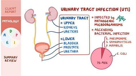 Video Urinary Tract Infections Utis Nursing Process Adpie