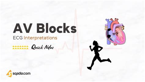 ECG Interpretations - AV Blocks