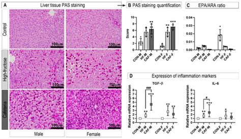 Cafeteria Diet And High Fructose Rodent Models Of Nafld Differ In The