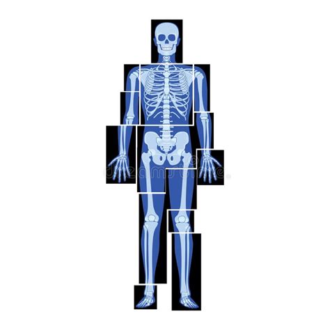 Conjunto De Esqueletos Xris Partes Del Cuerpo Humano Manos Piernas