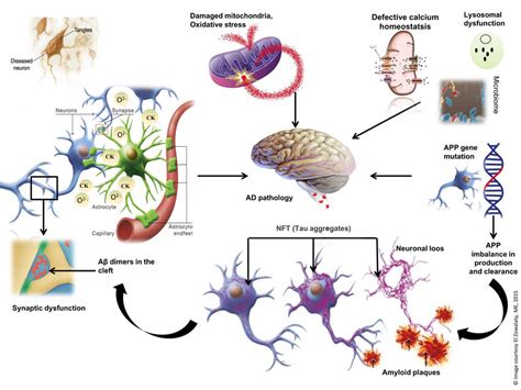 Schematic Representation Of The Pathology Of Alzheimers Disease