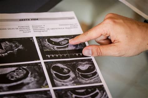 Nascem G Meos De Casal Gay Do Df Que Fertilizou Vulo De Parente Metr Poles