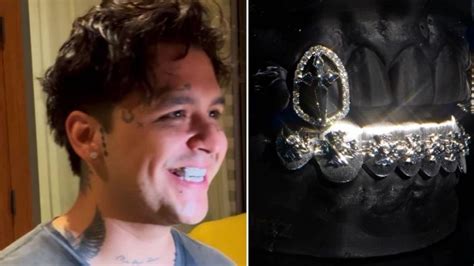 Cuánto vale la nueva dentadura de diamantes de Christian Nodal La