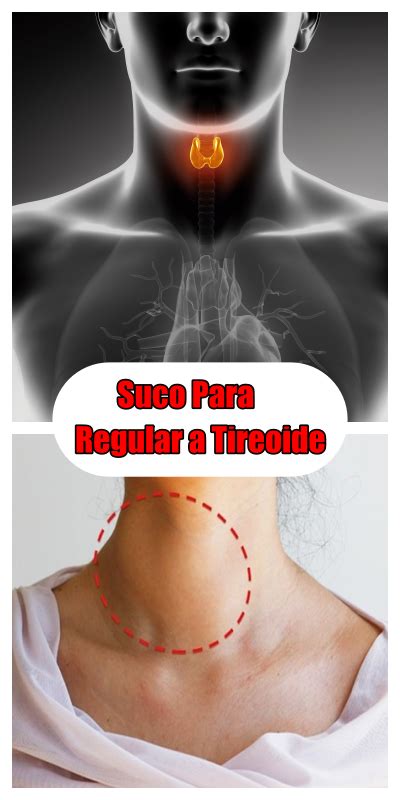 Beba Este Suco Para Regular A Tireoide Perder Peso E Combater