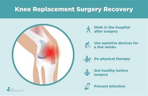 Knee Replacement Surgery Recovery What Doctors And Patients Want You