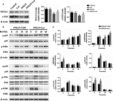 Inhibition Of PFKFB3 Suppresses Osteoclastogenesis And Prevents