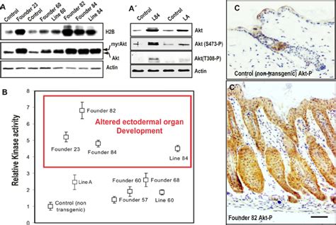 Akt Kinase activity in transgenic mice. (A) Top panel, representative... | Download Scientific ...