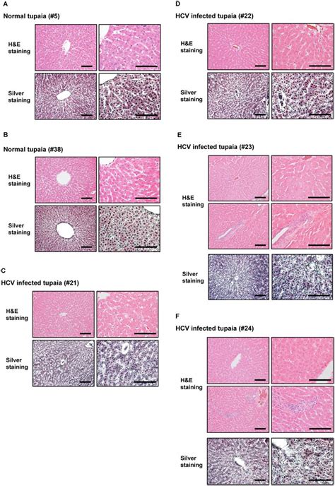 Histopathological Analysis Of Liver Tissues From Normal And Download Scientific Diagram