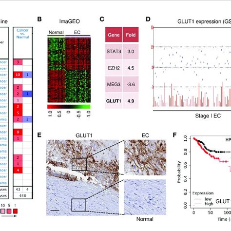 | GLUT1 Expression and Clinical Importance in EC. (A) The mRNA... | Download Scientific Diagram