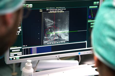 BipSee Biopsia Prostatica Con Imaging Multimodale Tema Sinergie