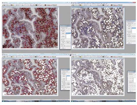 Figure 1 Immunohistochemical Expression Of Sex Steroid Hormone