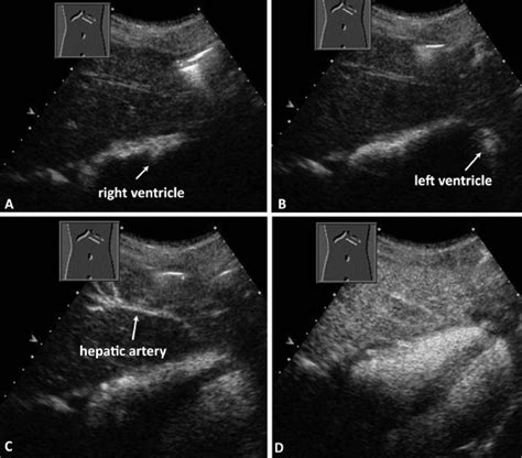 WFUMB Technological Review How To Perform Contrast Enhanced Ultrasound