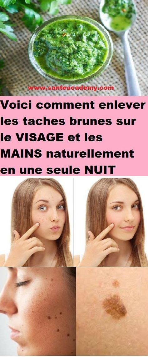 Voici Comment Enlever Les Taches Brunes Sur Le Visage Et Les Mains