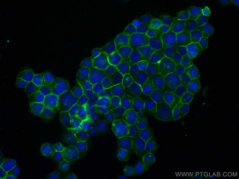 Lat Antibody Rr Proteintech