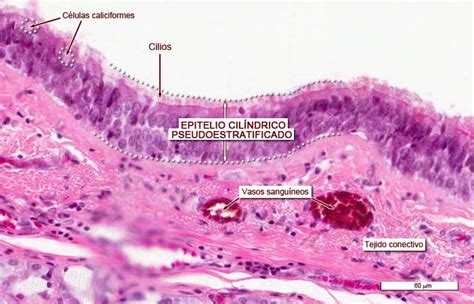 Epitelio Cilíndrico Pseudoestratificado Ciliado