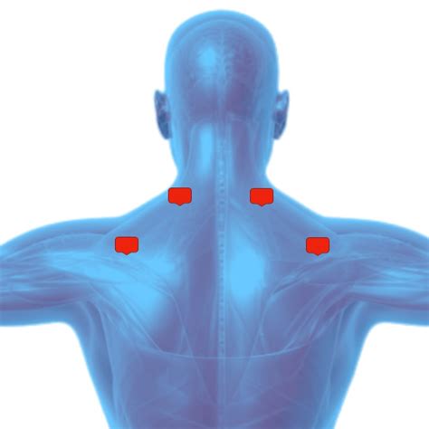 Shoulder Pain Tens Electrode Placement