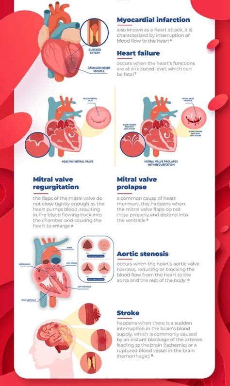 Infographic Types And Causes Of Heart Disease Boomers Daily