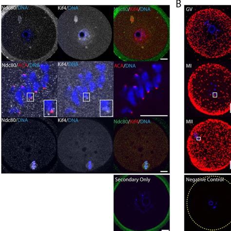 Kif4 Co Localizes And Interacts With Outer Kinetochore Ndc80 Throughout