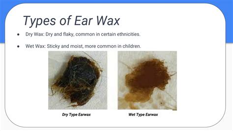 PPT - 2.Ear Wax PowerPoint Presentation, free download - ID:12170557