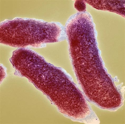 Cholera Bacteria Photograph By Ami Imagesscience Photo Library