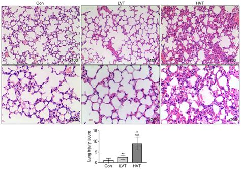 Targeting Notch Activated M1 Macrophages Attenuate Lung Tissue Damage